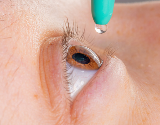 Nahaufnahme eines braunen Auges, über dem eine Tropfenflasche mit grünem Kopf einen Tropfen abgibt.