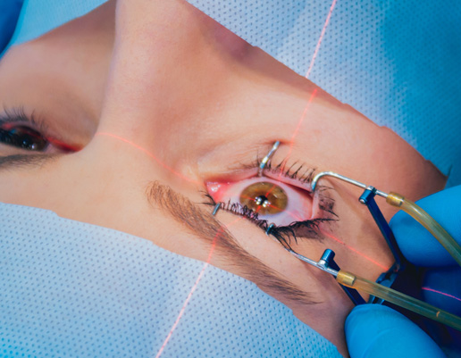 Nahaufnahme eines Auges mit medizinischem Instrument und Laserstrahl während eines Eingriffs, Person trägt OP-Haube und Handschuhe.